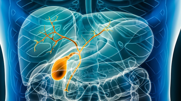 Safra Kesesi Ameliyatı (Kolesistektomi) Nedir? Belirtileri, Tedavi Yöntemleri ve Süreç